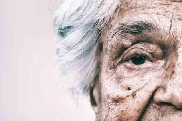 بیماری‌های پوستی کیفیت زندگی سالمندان را می‌کاهد