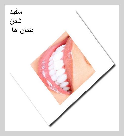 محصولات سفید کننده دندان
