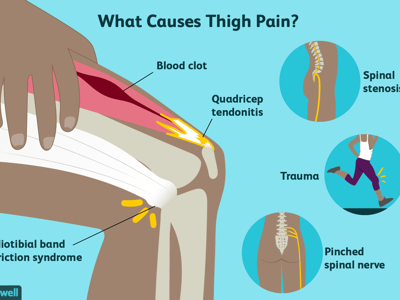 علت و درمان پا درد چیست ؟