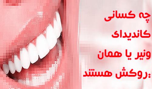 چه کسانی کاندیدای ونیر یا همان روکش هستند: