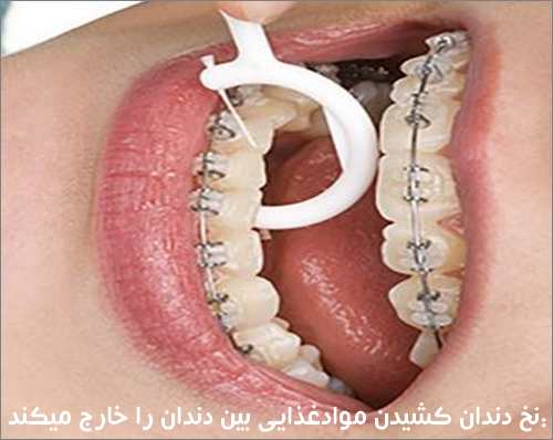 نخ دندان کشیدن موادغذایی بین دندان را خارج میکند:
