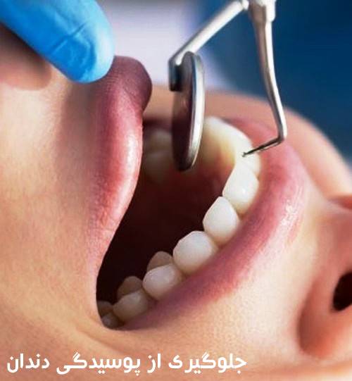 چگونه از بروز رفتن دندانپزشکی جلوگیری کنیم و گریبان ما را نگیرد
