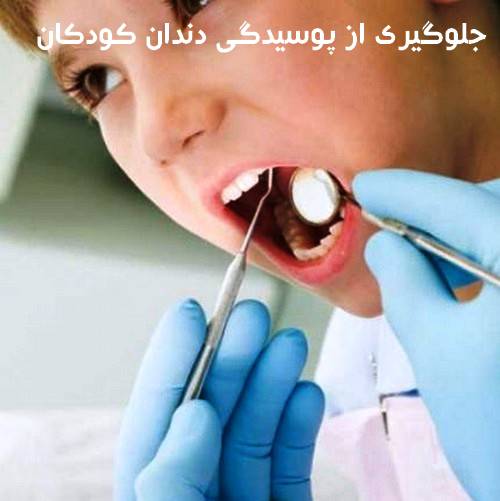 چگونه از بروز رفتن دندانپزشکی جلوگیری کنیم