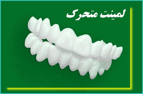 لمینت متحرک برای چه دندان هایی خوب است :